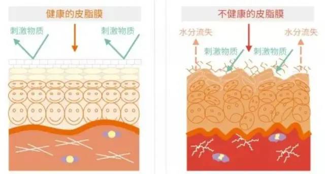 化妝品,皮膚,保濕,皮膚干燥,成分,角質層